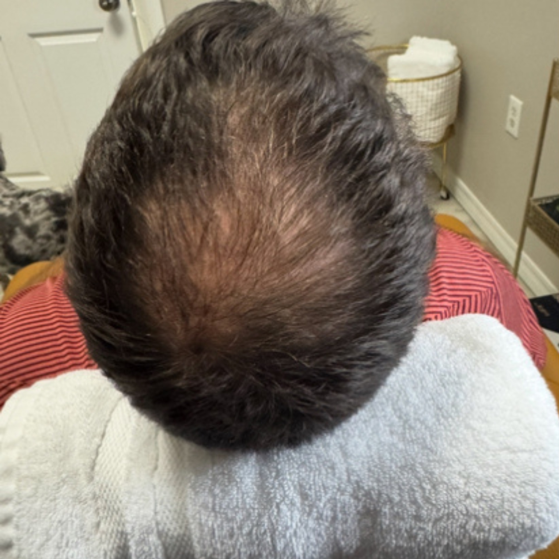 Before